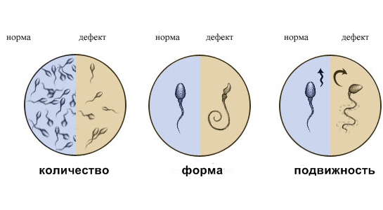 Сдать спермограмму в Перми: цены на анализ спермы - Клиника репродукции «Философия жизни»
